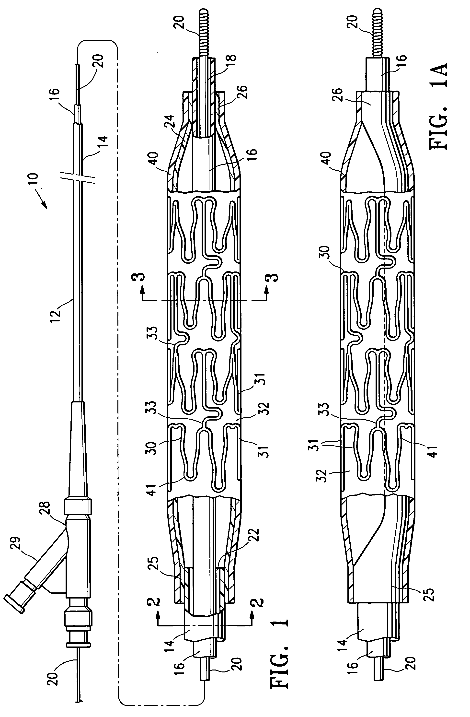 Stent delivery balloon catheter having improved stent retention