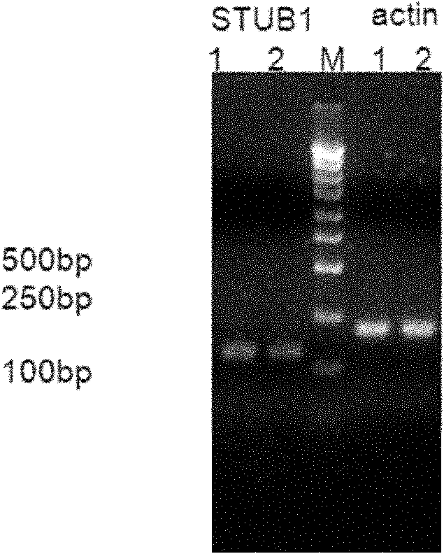 Application of E3 ubiquitin ligase CHIP in gliomatosis cerebri disease