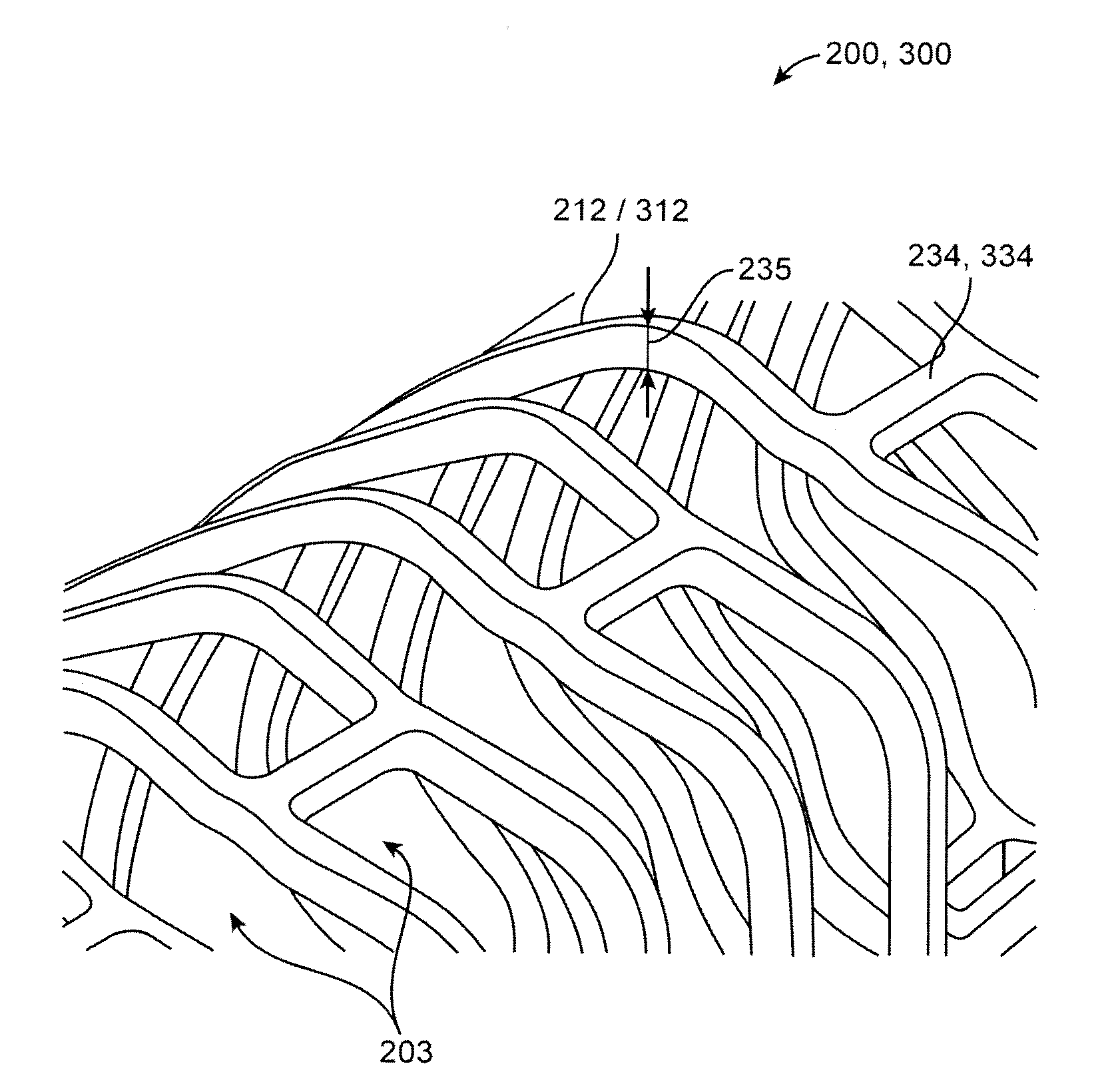 Polymer scaffolds for peripheral vessels