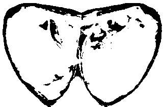 Preparation method of hyriopsis cumingii pallium tissue slice