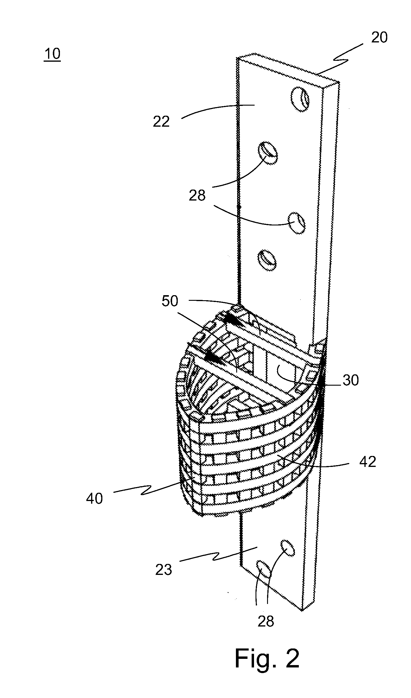 Bone Loss Plate