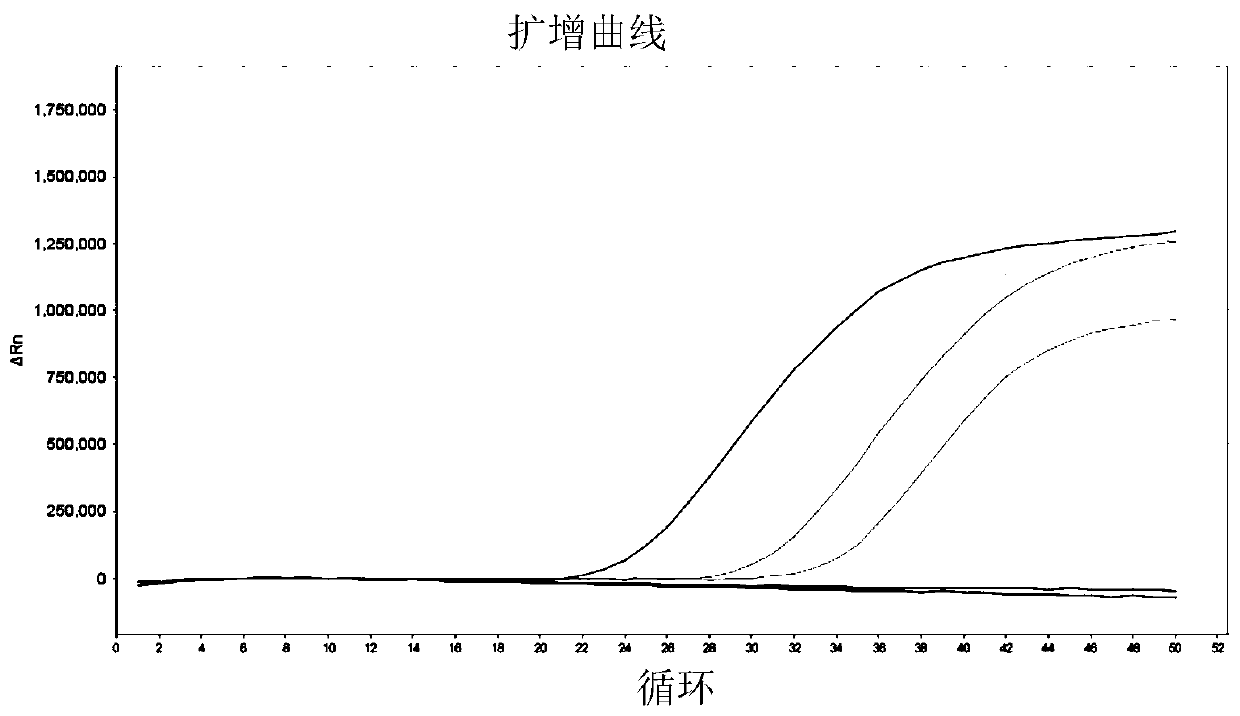 Detection kit for detecting biomarker of bladder cancer