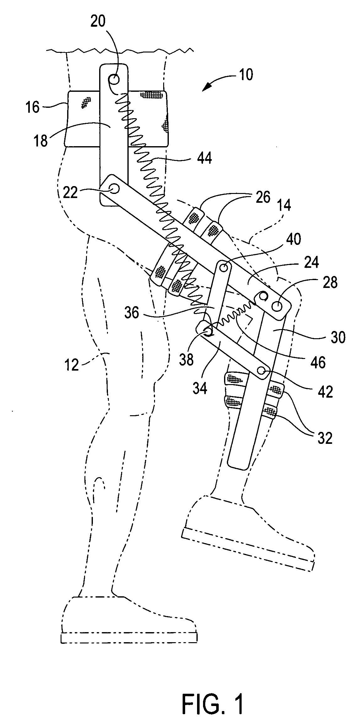 Gravity balanced orthosis apparatus