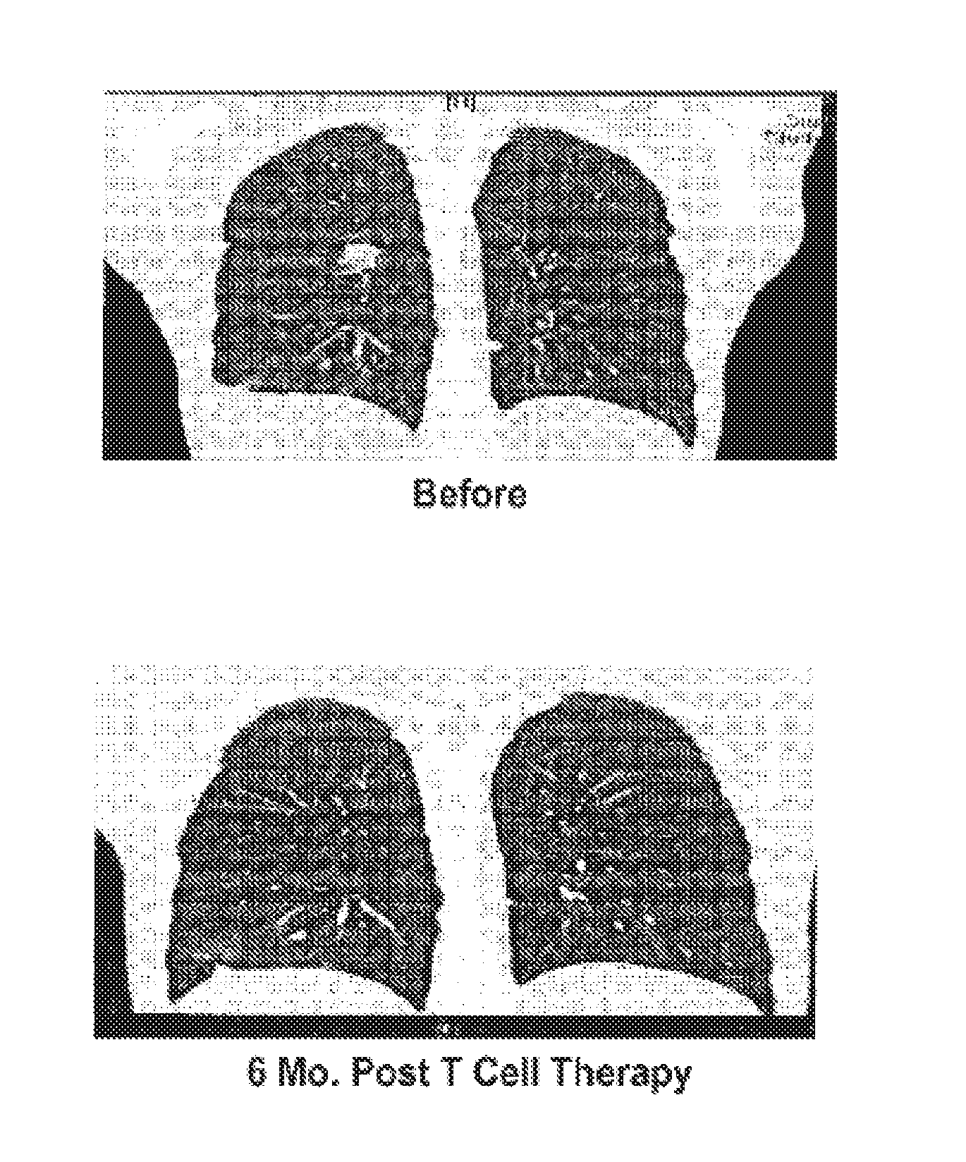 Modulated immunodominance therapy