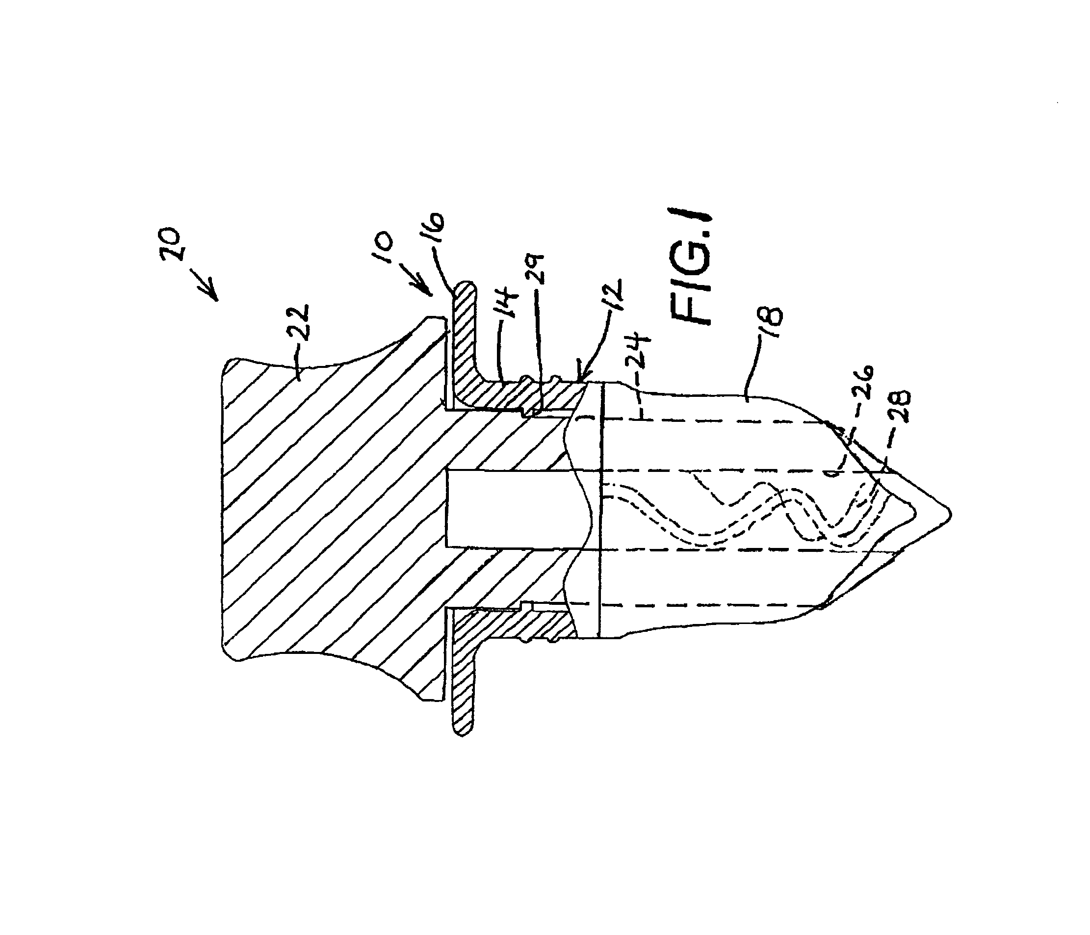 Laparoscopic port assembly