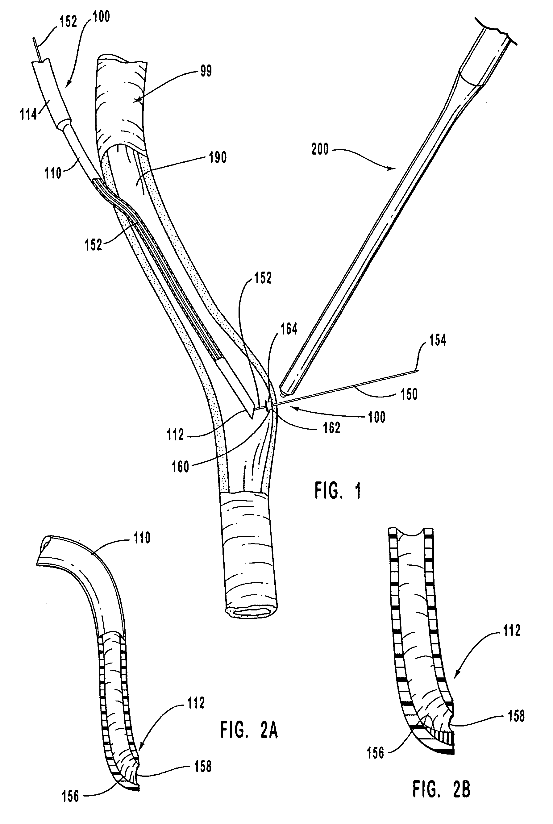 Methods for anastomosis of a graft vessel to a side of a receiving vessel