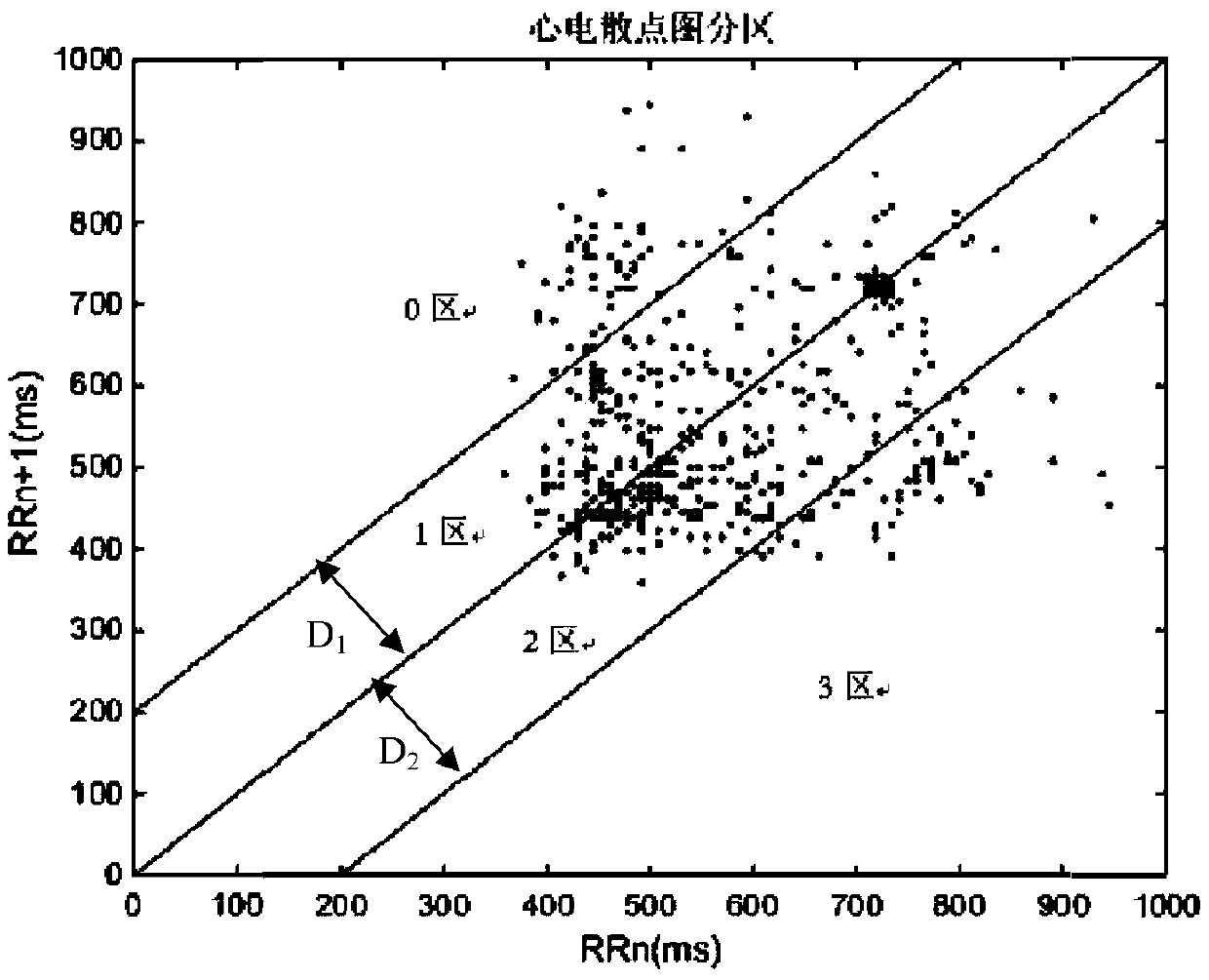 Electrocardio feature analyzing method based on point diagram and symbolic dynamics