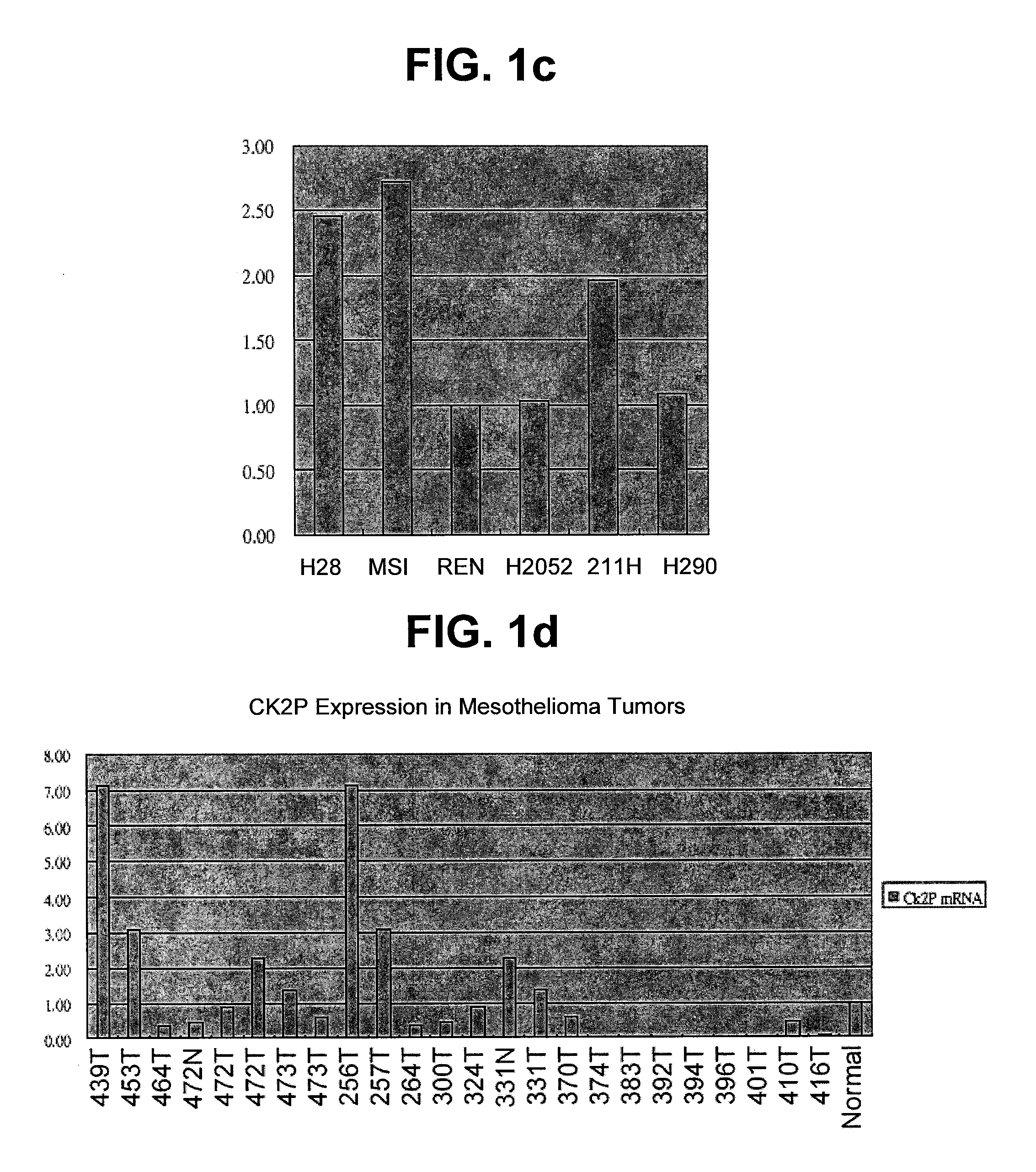 Protein kinase CK2 gene mutations, amplifications and polymorphisms in human cancers and methods of use