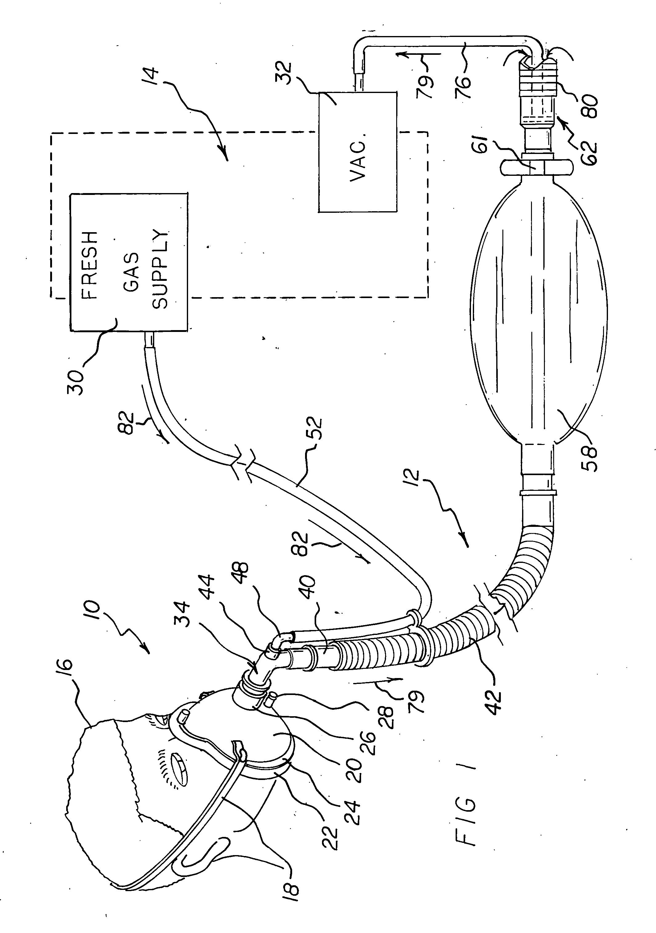 Respiratory face mask and breathing circuit assembly