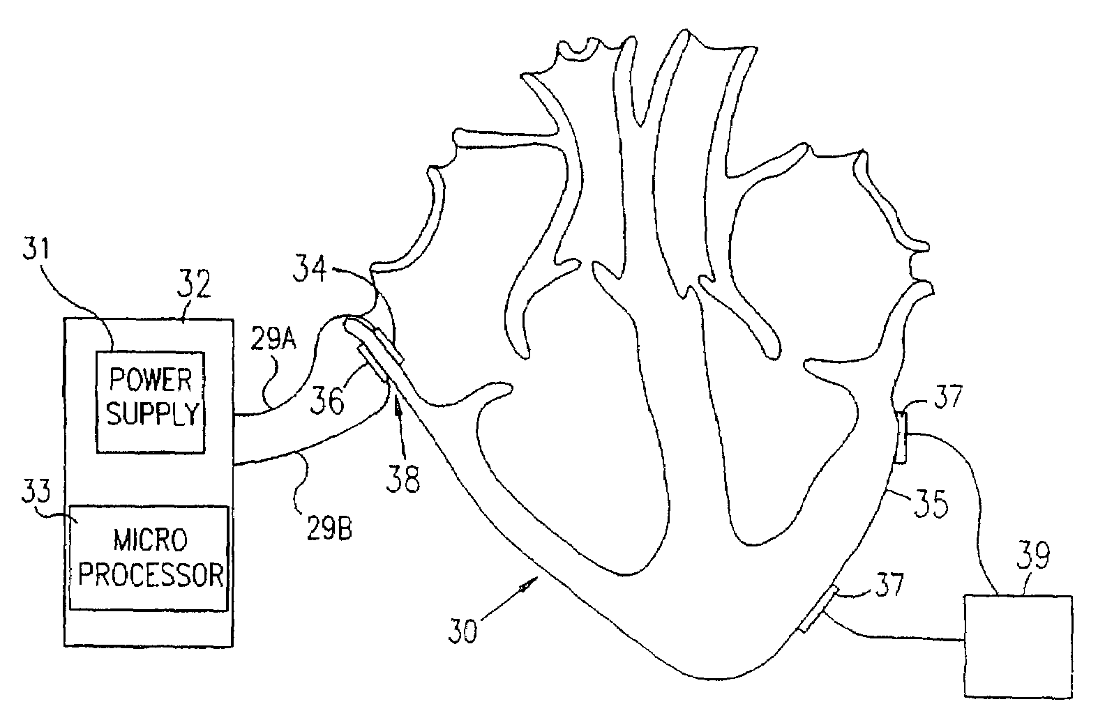 Electrical muscle controller