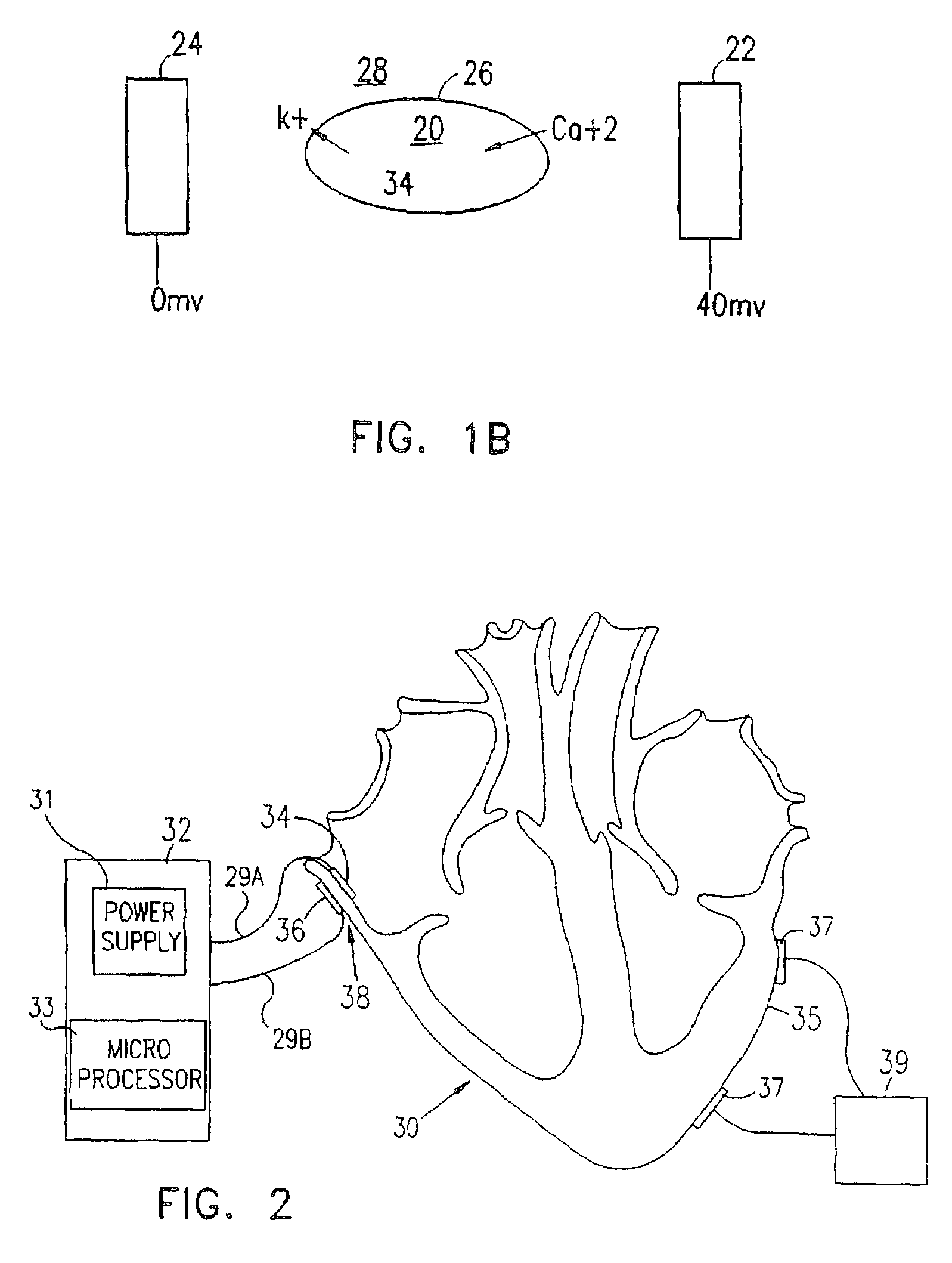 Electrical muscle controller