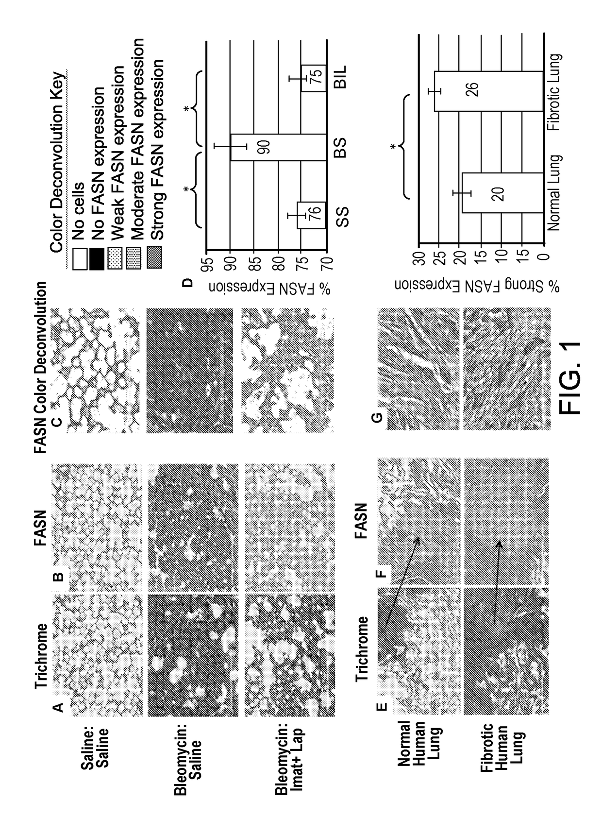 Using fatty acid synthase inhibitors to treat fibrosis