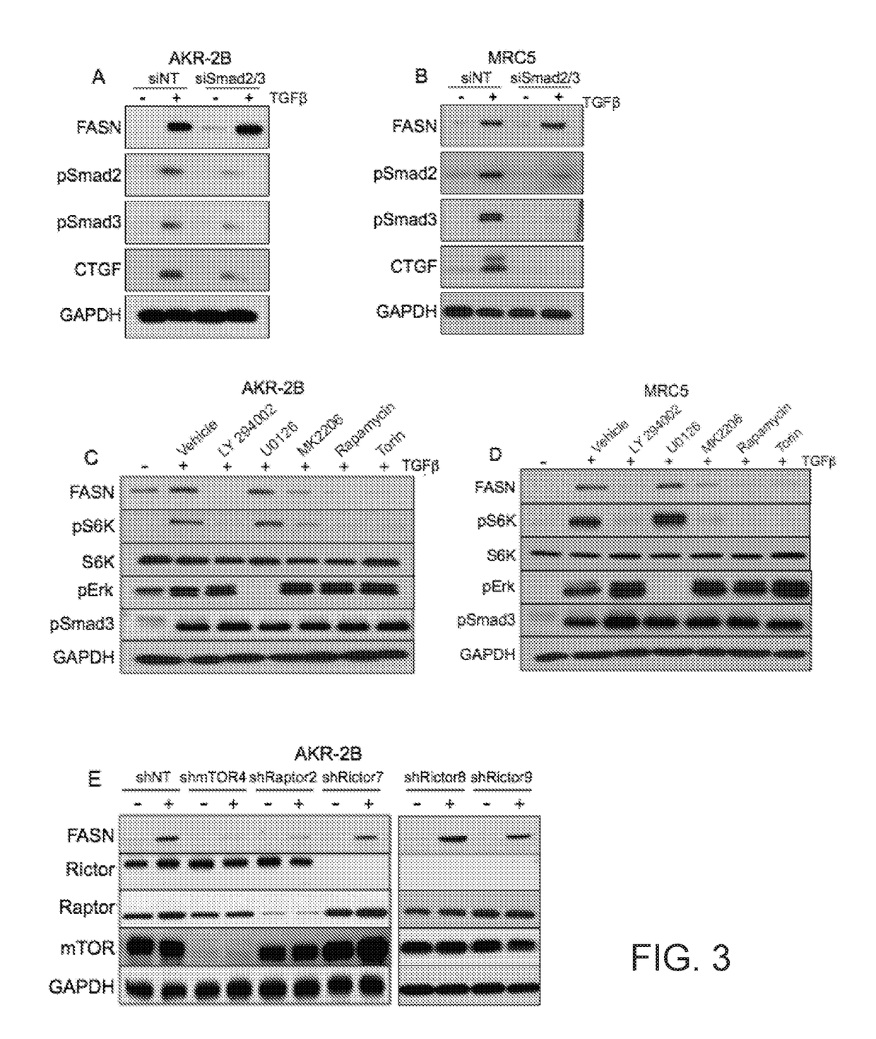 Using fatty acid synthase inhibitors to treat fibrosis