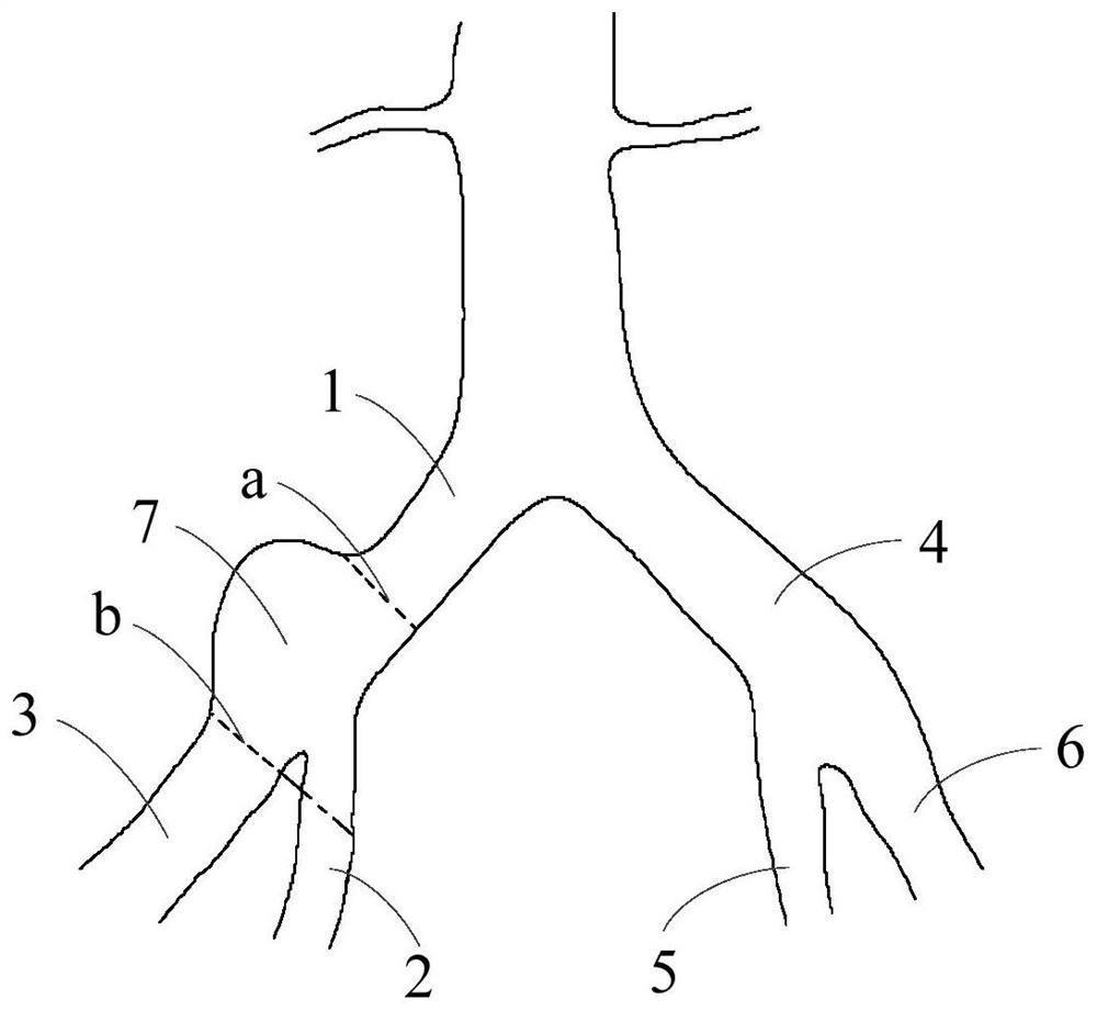 Branched Vascular Stent