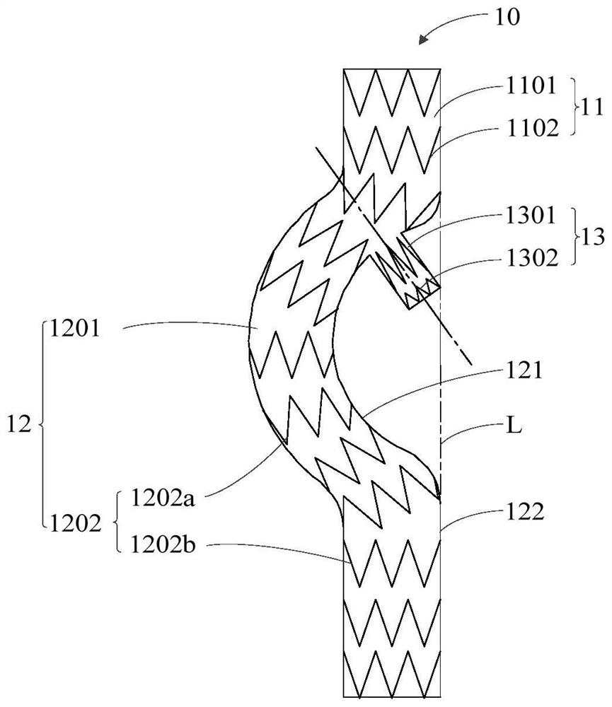 Branched Vascular Stent