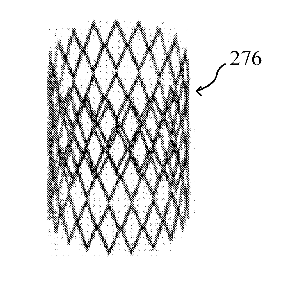 Engineered polymeric valves, tubular structures, and sheets and uses thereof