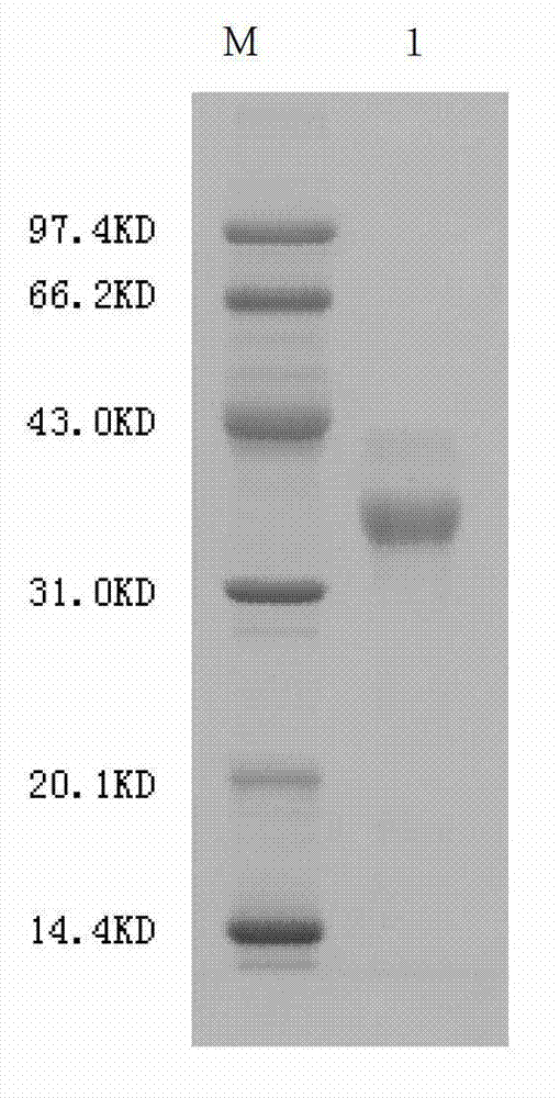 Agkistrodon acutus hemocoagulase-B