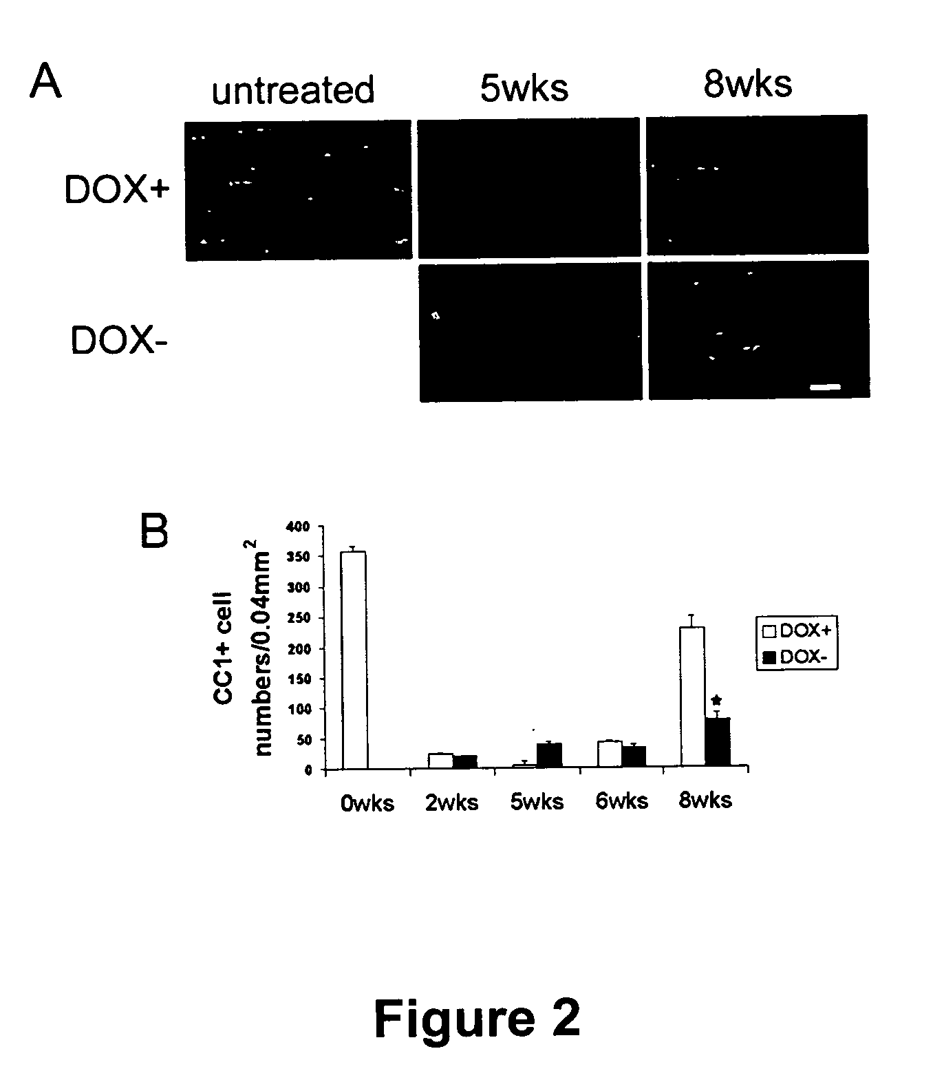 Methods for treating demyelination disorders