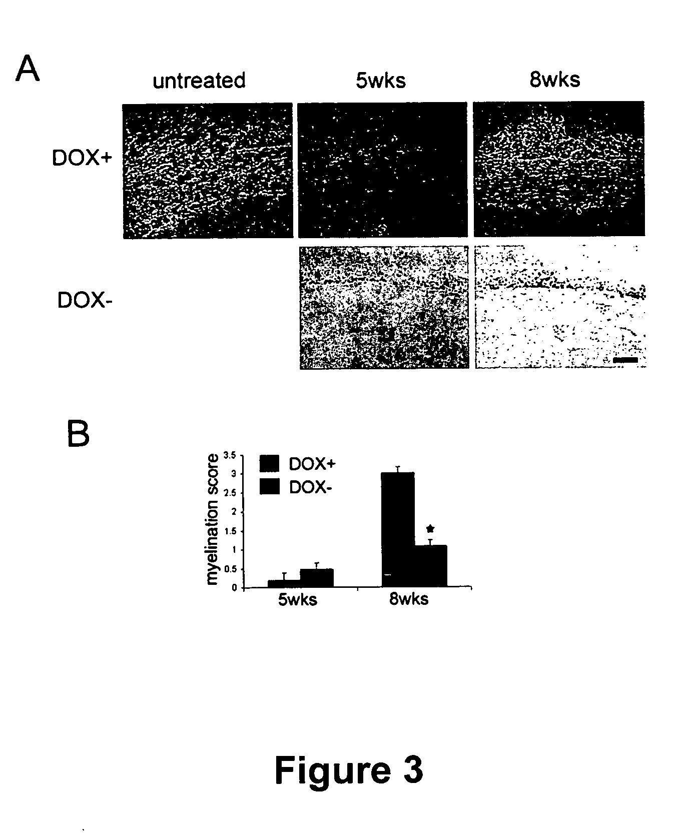 Methods for treating demyelination disorders