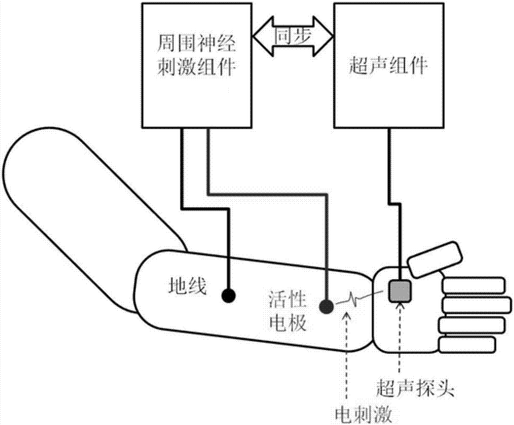 Ultrasonic component and peripheral nerve stimulator based apparatus and method for detecting motor nerve feedback