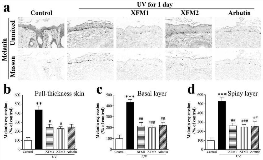 External whitening and freckle-removing essence snow skin rice for treating skin stains and preparation method and application thereof