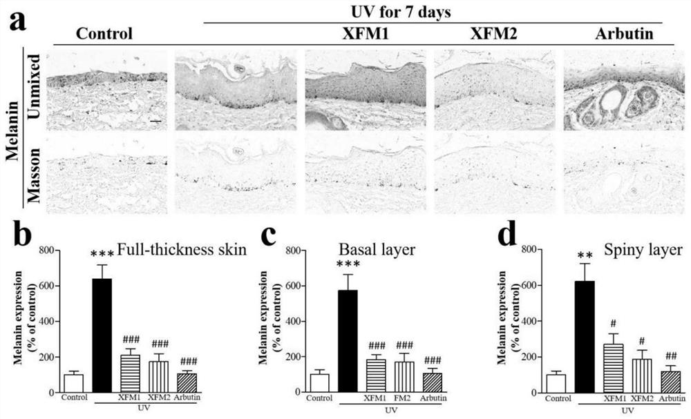 External whitening and freckle-removing essence snow skin rice for treating skin stains and preparation method and application thereof