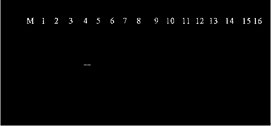 Primers and method for quickly detecting Takifugu obscurus young fish sex difference single base mutation