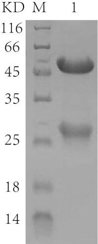 A kind of 3-hydroxybutyrylation modified protein drug and its preparation method and application