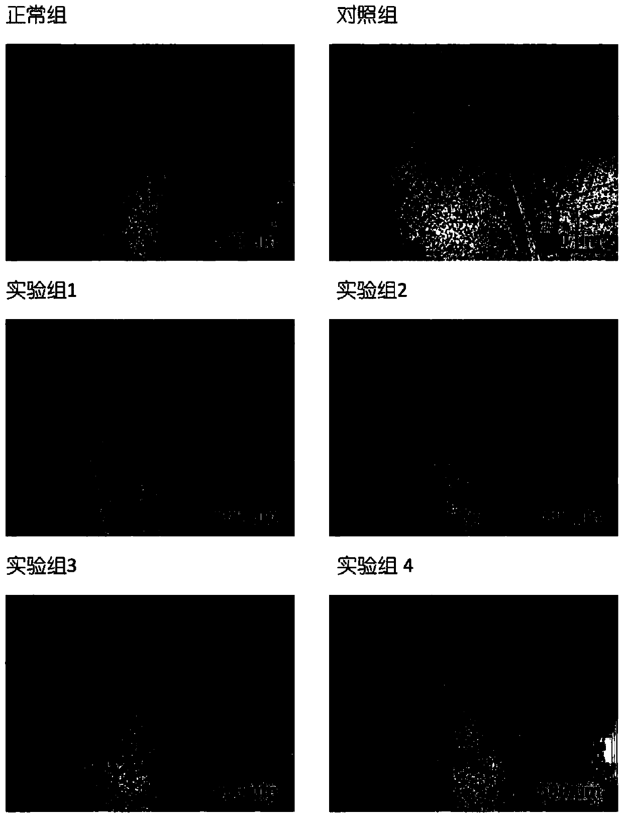 Composition having function of inhibiting fat formation and antioxidant activity and application of composition