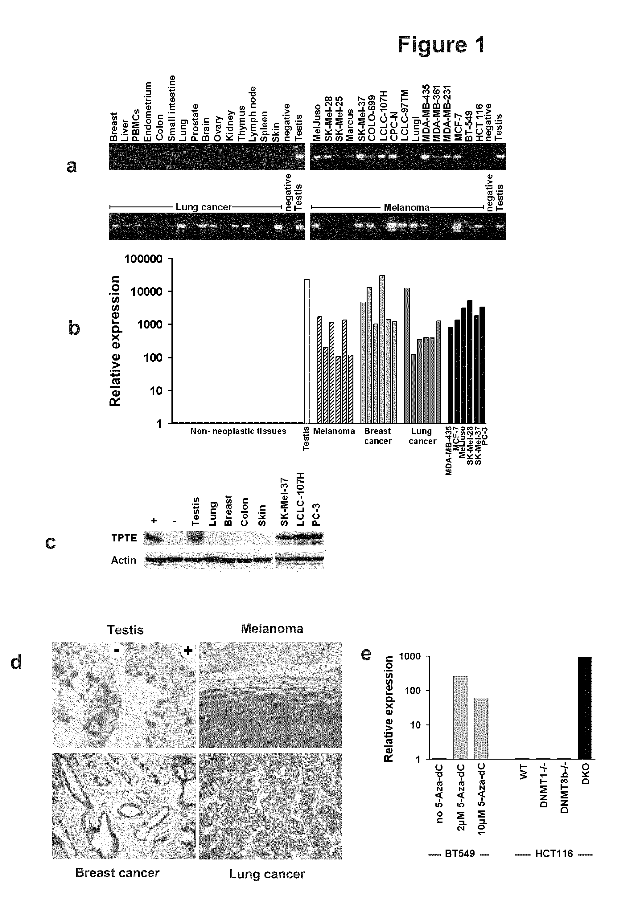 Compositions and Methods for Therapy and Diagnosis of Cancer and Cancer Metastasis