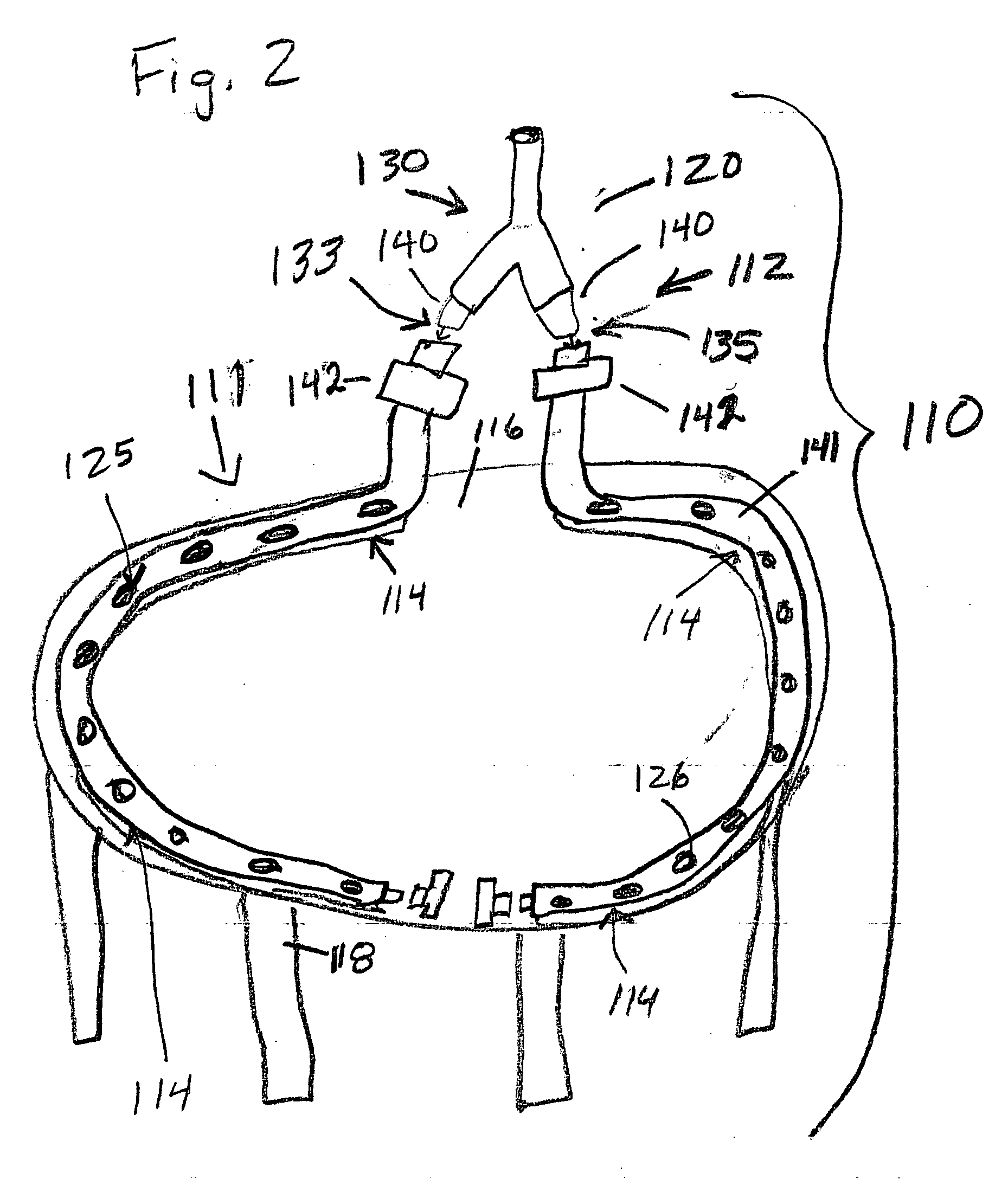 Trampoline accessory