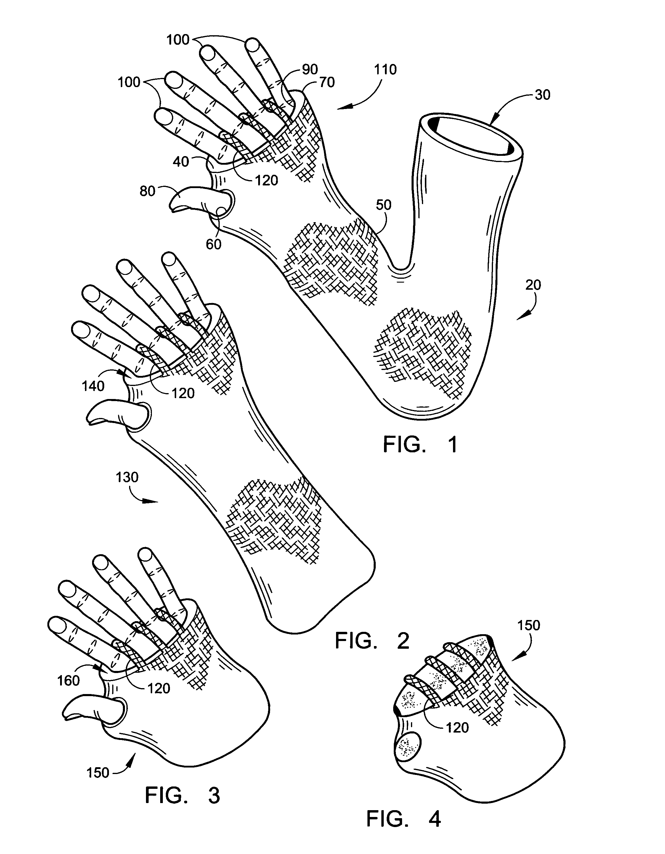 Cast cover and method of use