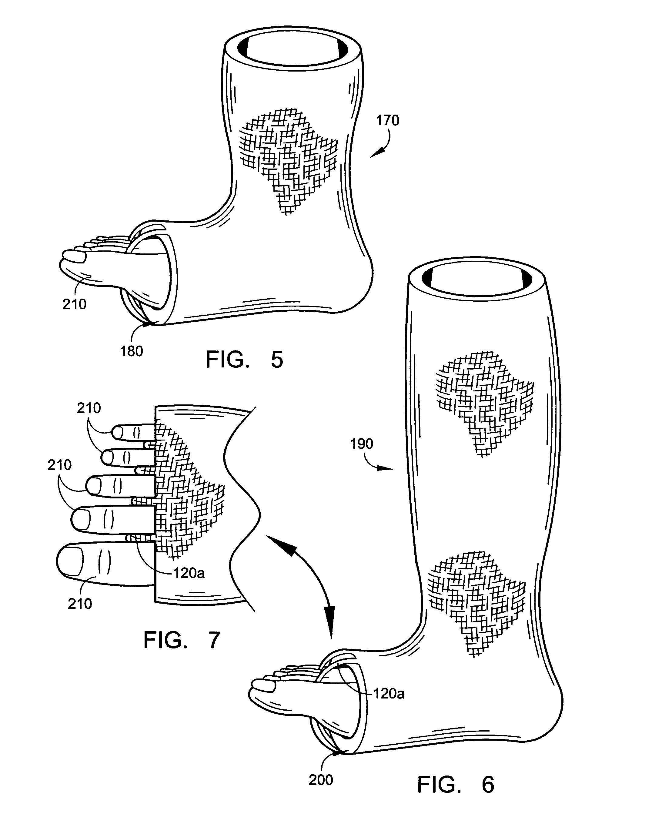 Cast cover and method of use