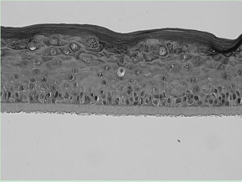 A kind of construction method of 3D epidermis model