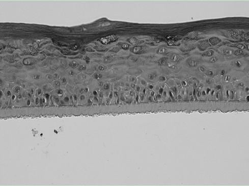 A kind of construction method of 3D epidermis model