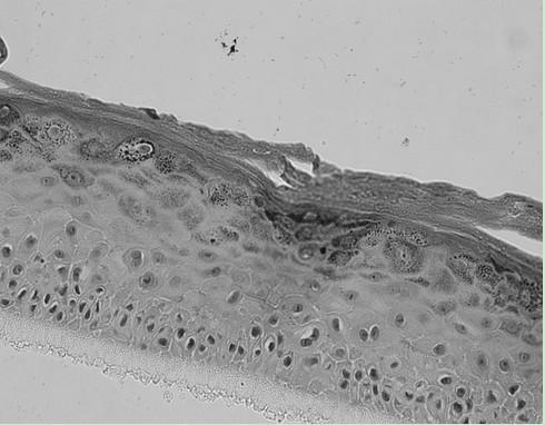 A kind of construction method of 3D epidermis model