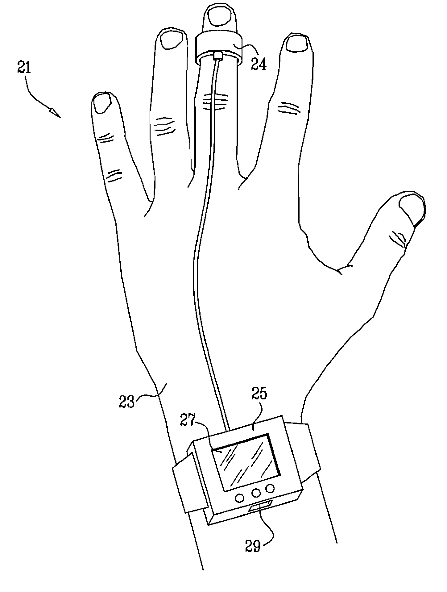 Detection of cardiac arrhythmias using a photoplethysmograph