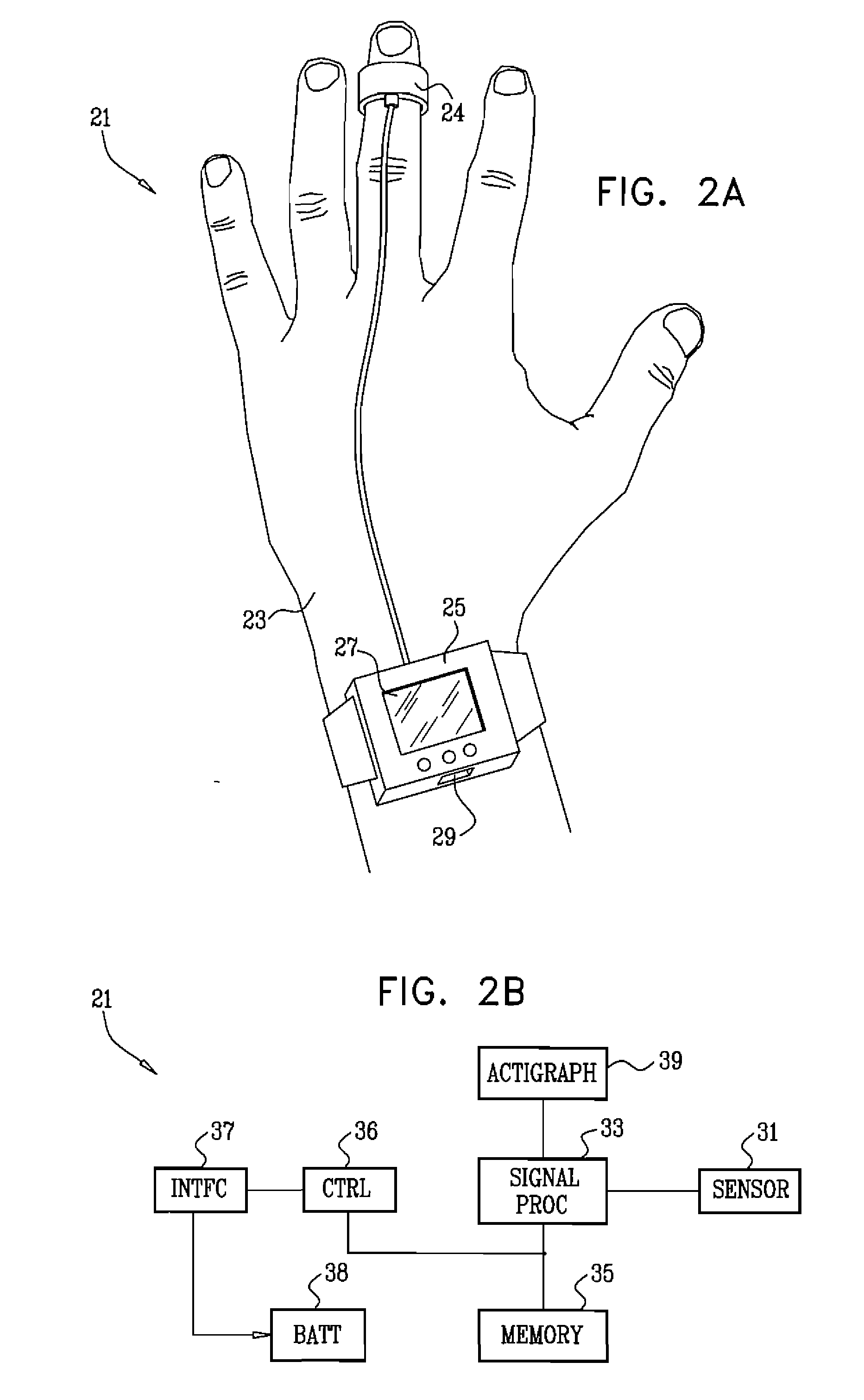 Detection of cardiac arrhythmias using a photoplethysmograph