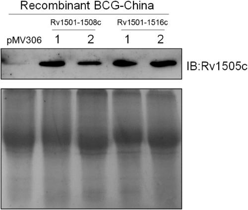 Recombinant bacillus calmette guerin vaccine, and applications thereof