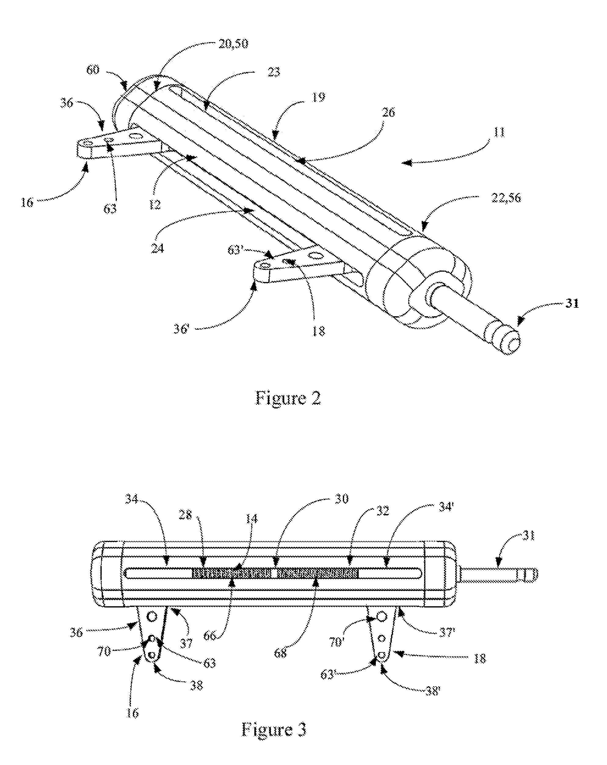 Bone compression and distraction system