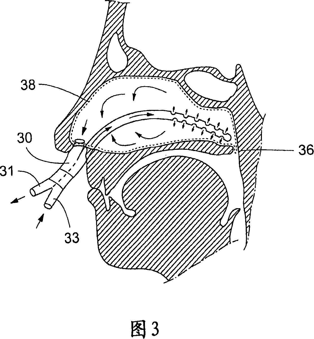 Cerebral temperature control