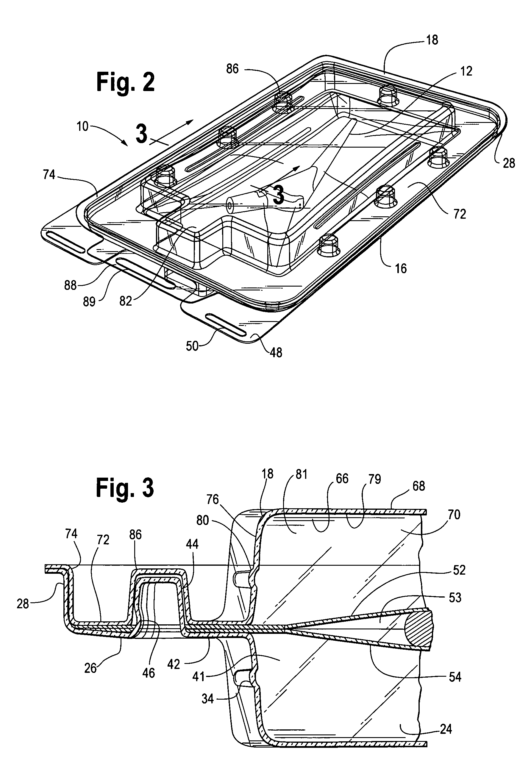 Suspension package