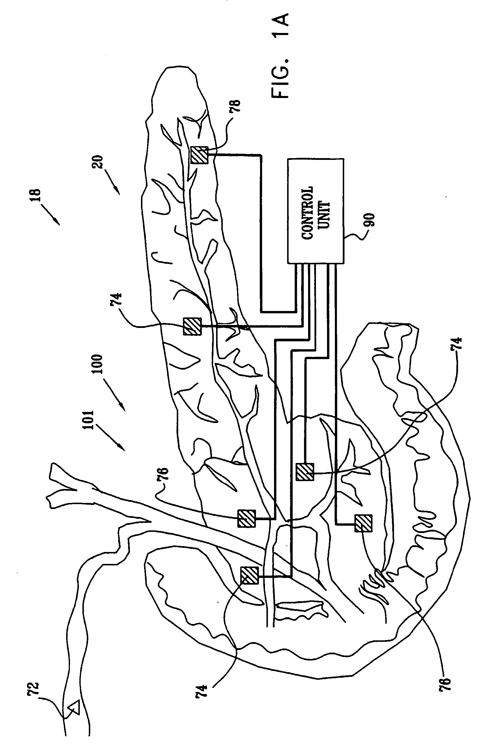 Sensing of pancreatic electrical activity