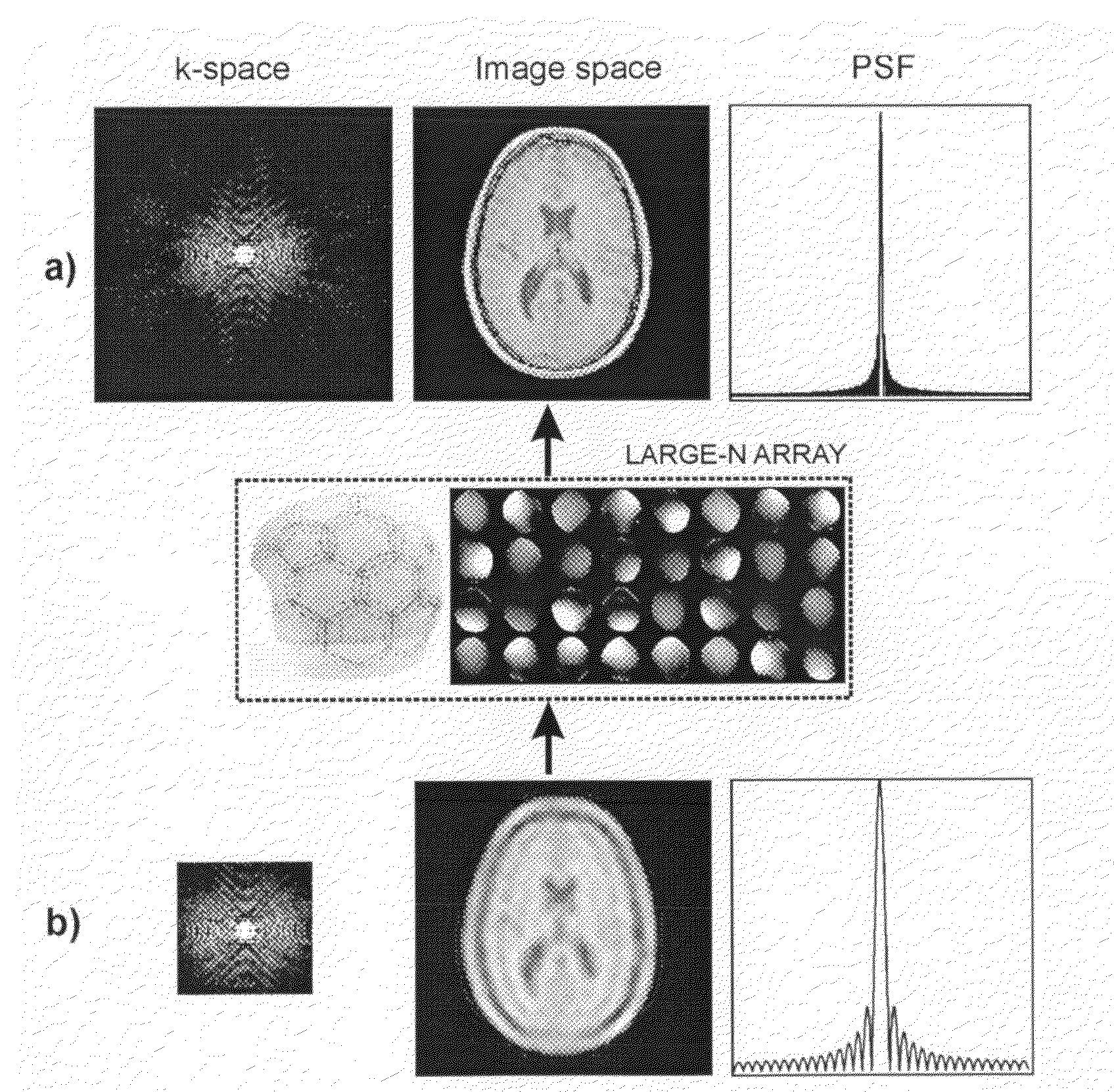 Superresolution parallel magnetic resonance imaging