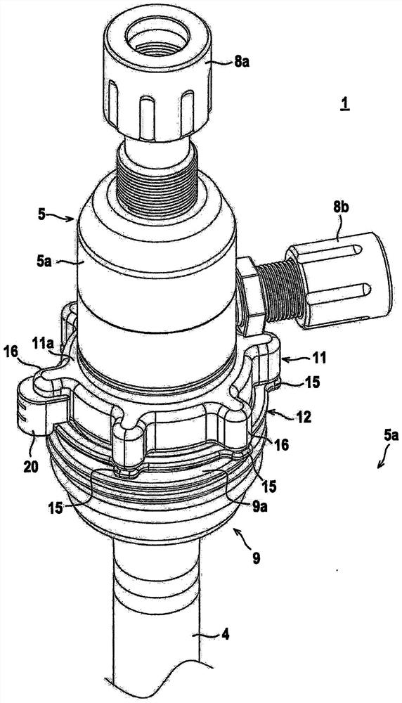 extraction system