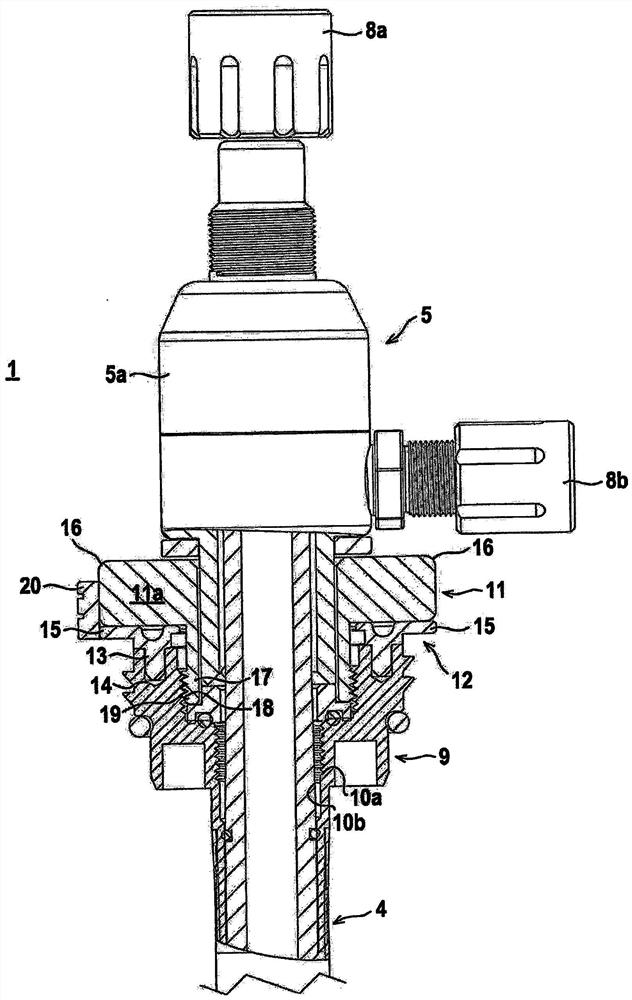 extraction system