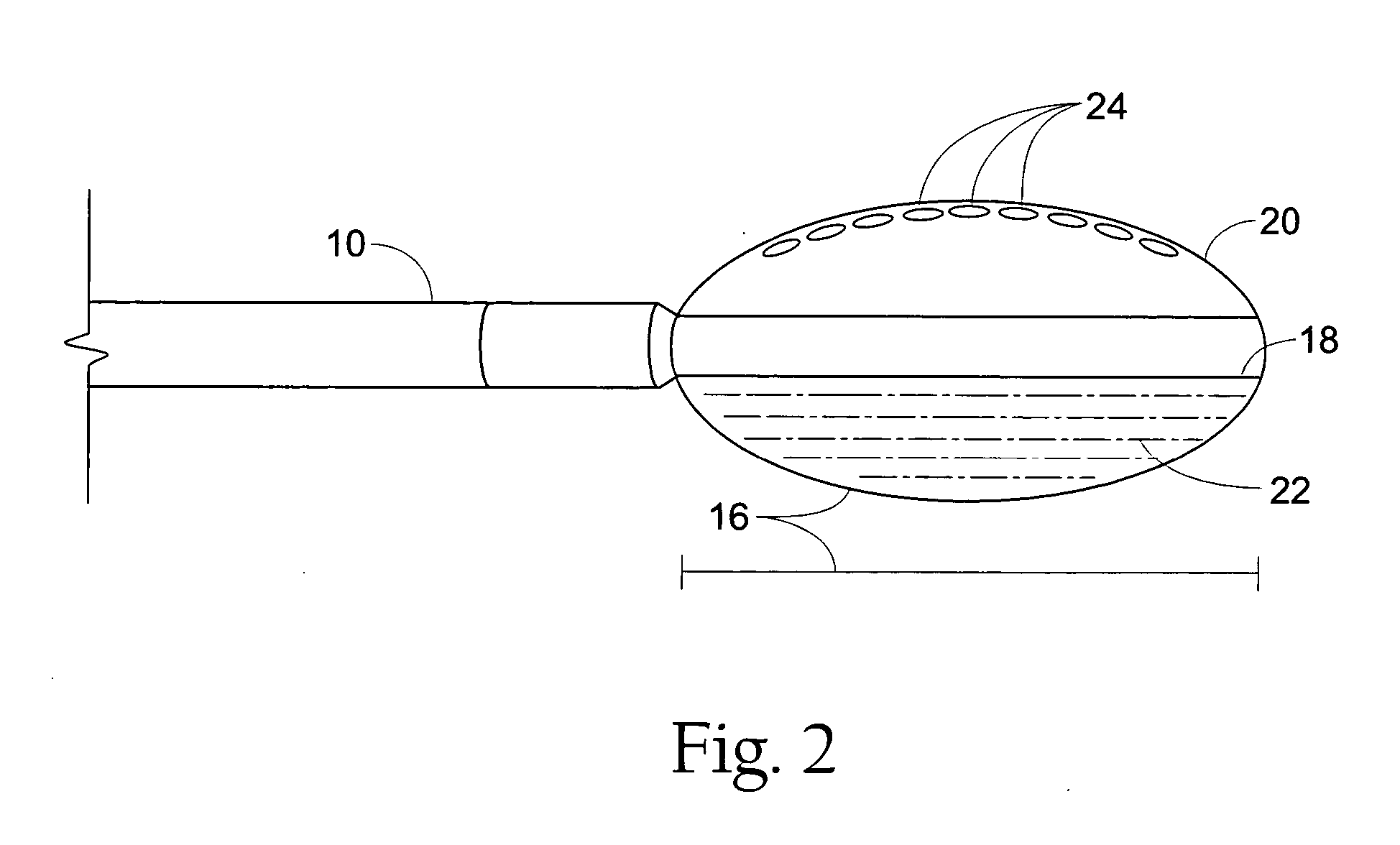 GERD treatment apparatus and method