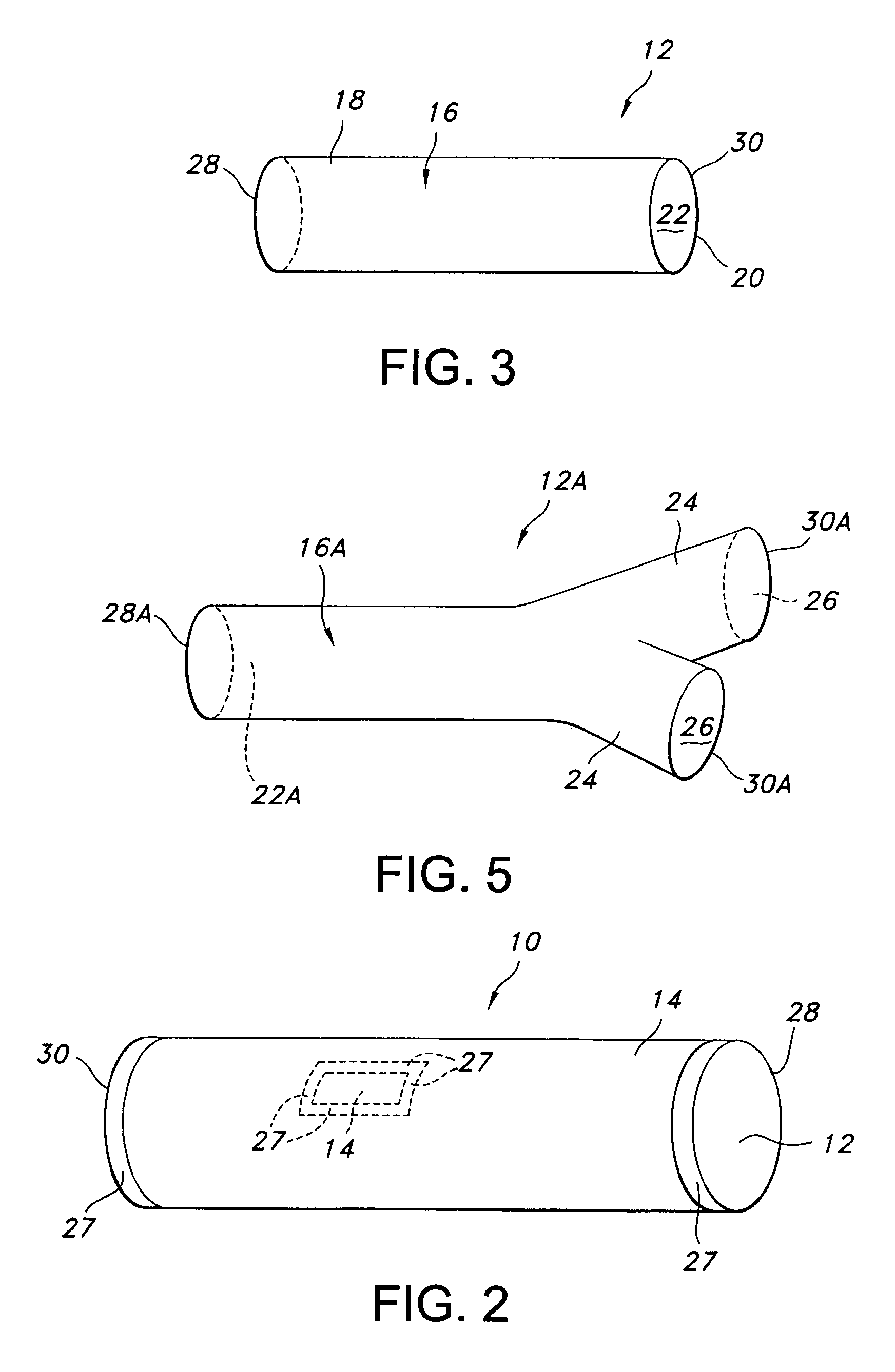 Tubular prosthesis for external agent delivery