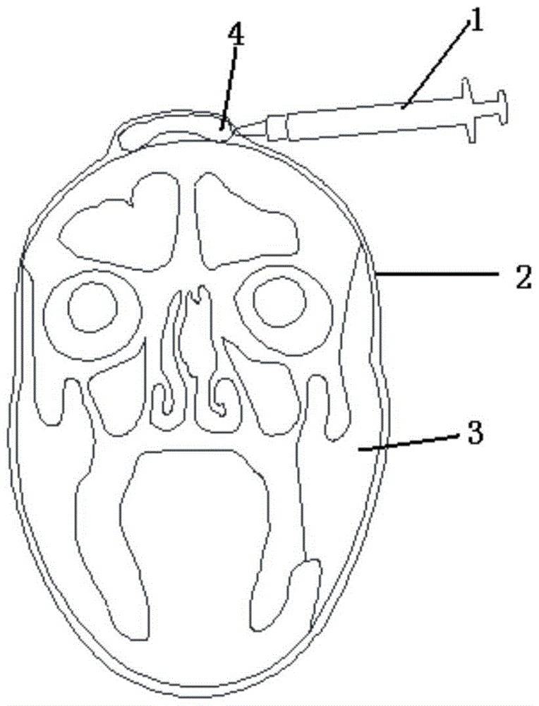 A Simulator for Scalp Expansion and Transplantation