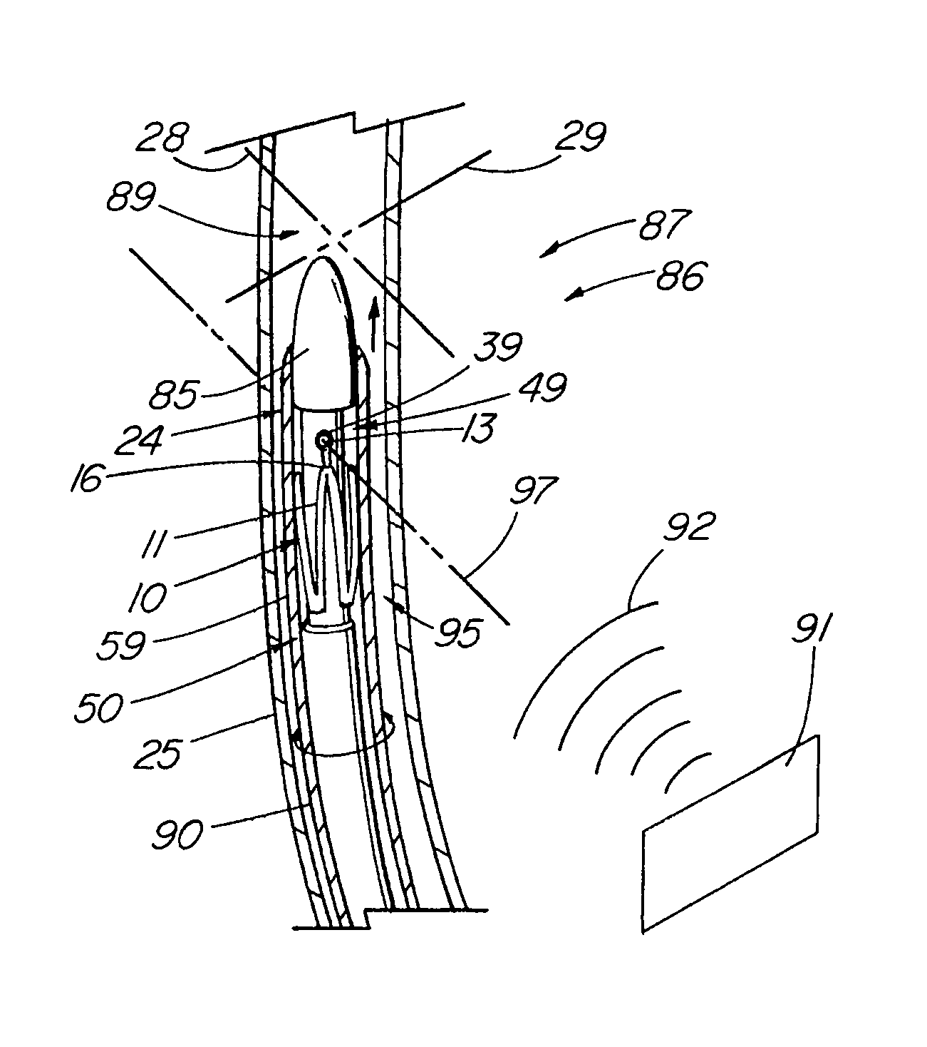 Prosthesis adapted for placement under external imaging